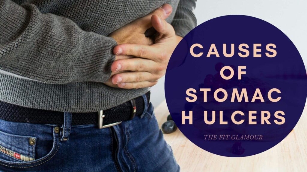 causes of stomach ulcers
