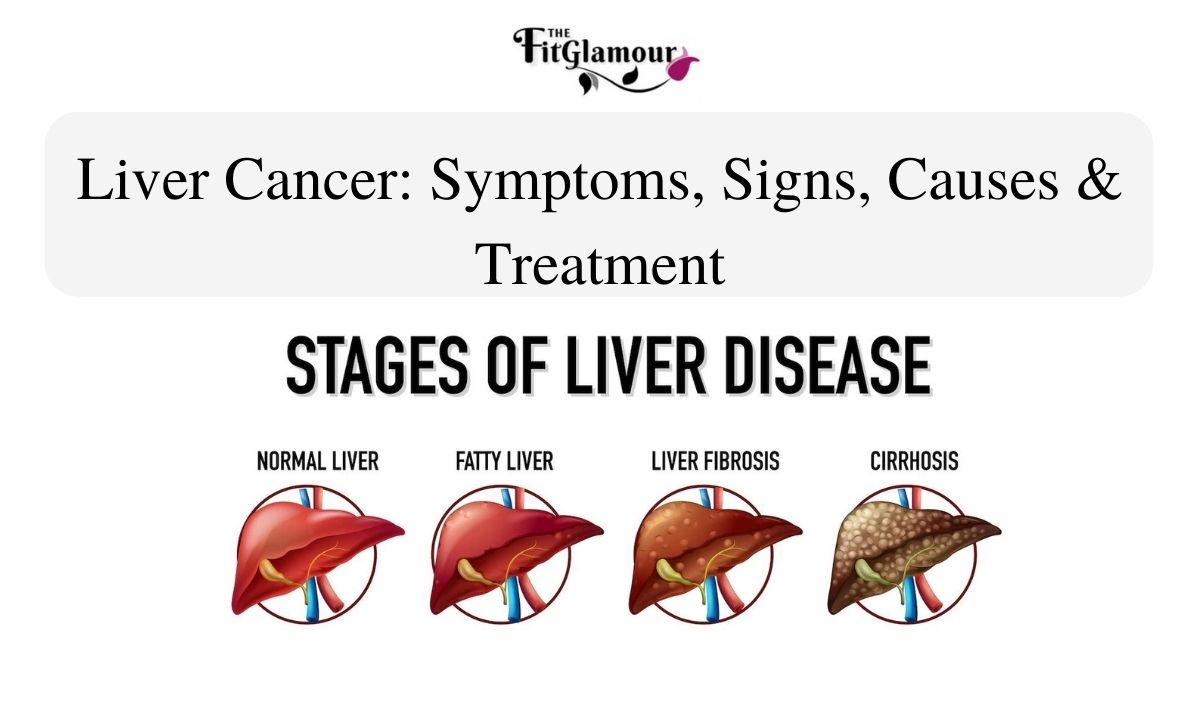 liver cancer disease